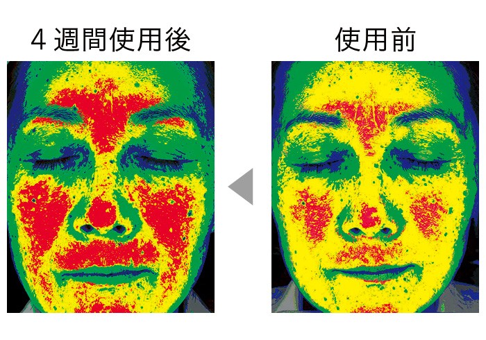 セラムバイタル配合のクリームを4週間使用することで、顔の高い部分を示す赤い色が増え、顔全体(特に頬)のハリが出て、リフトアップされた。(三省製薬調べ)